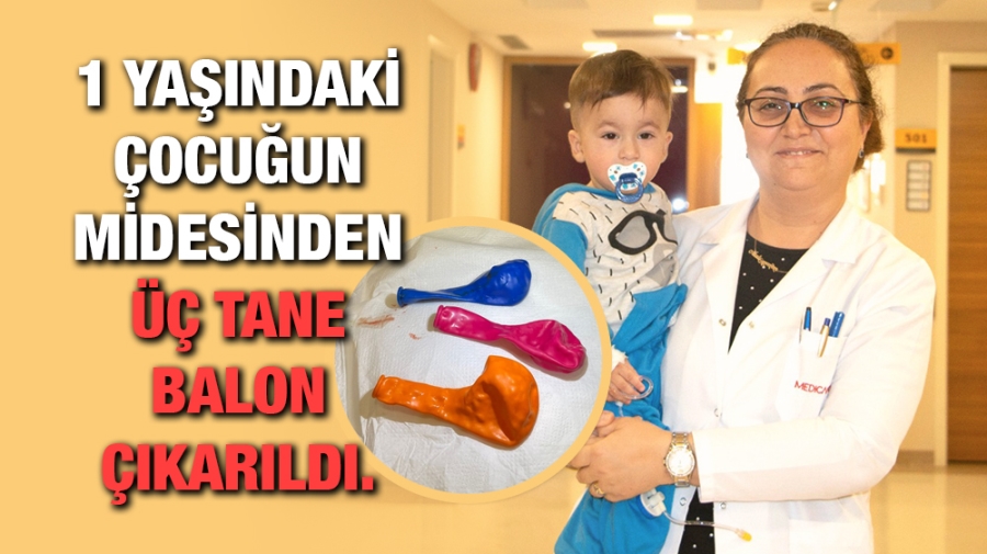 1 Yaşındaki Çocuğun Midesinden Üç Tane Balon çıkarıldı.