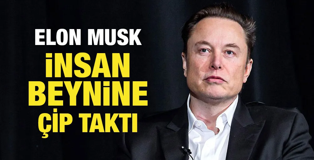 Elon Musk insan beynine çip yerleştirdi