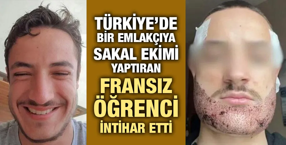 Türkiye’de bir emlakçıya sakal ekimi yaptıran Fransız öğrenci intihar etti