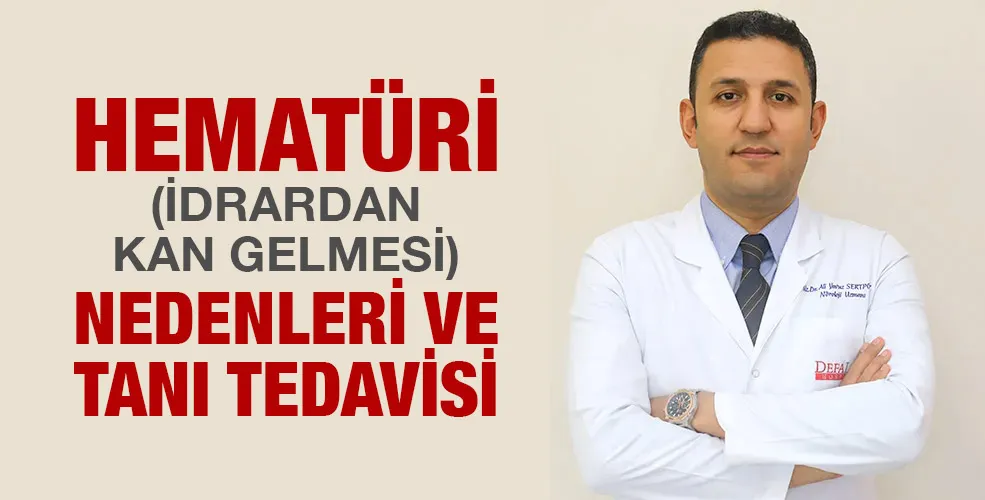 Hematüri (İdrardan Kan Gelmesi) nedenleri ve tanı tedavisi