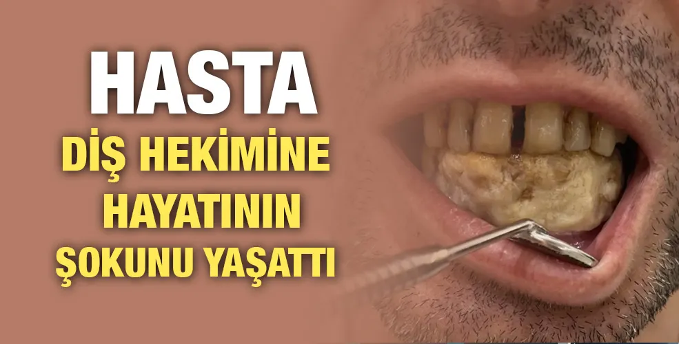 Hasta diş hekimine hayatının şokunu yaşattı