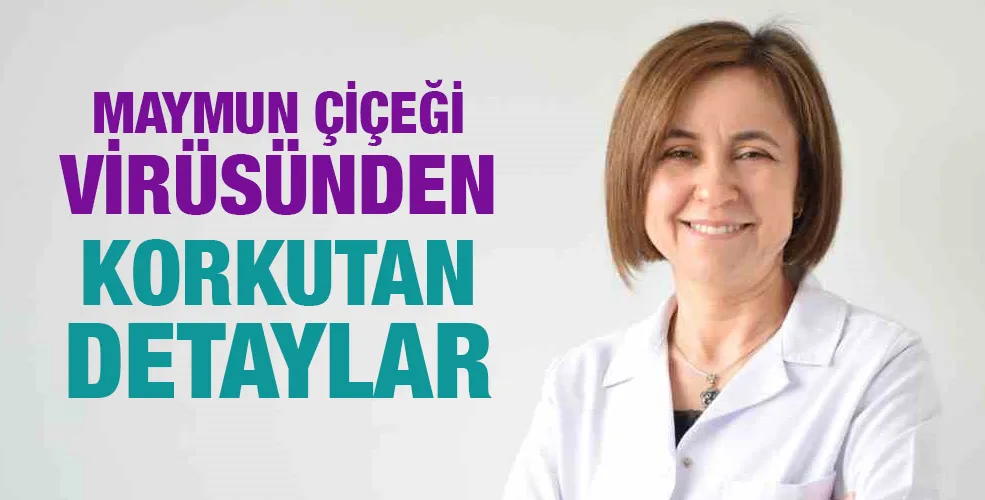 Maymun Çiçeği Virüsünden korkutan detaylar