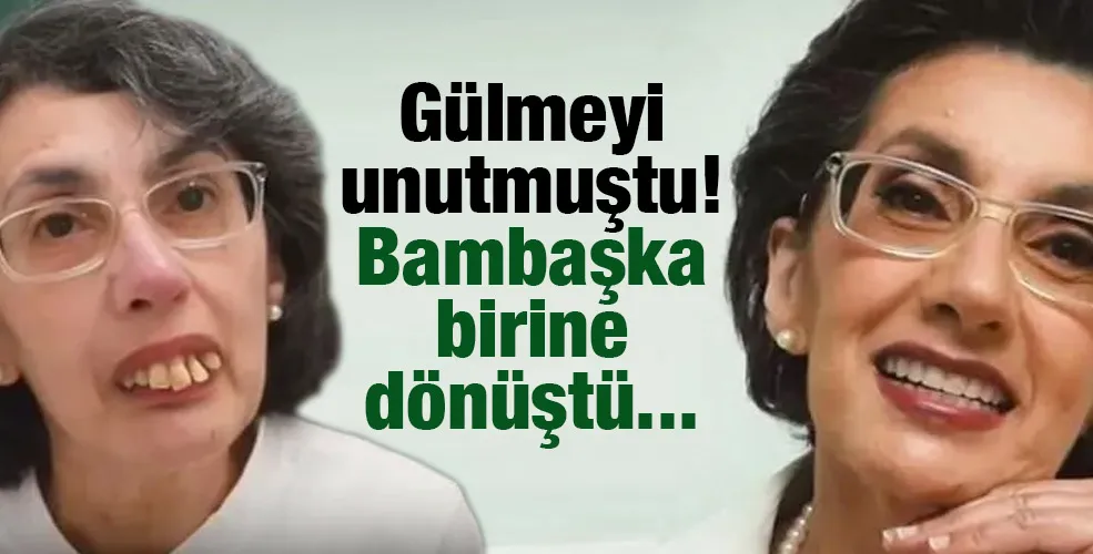 Gülmeyi unutmuştu! Bambaşka birine dönüştü...