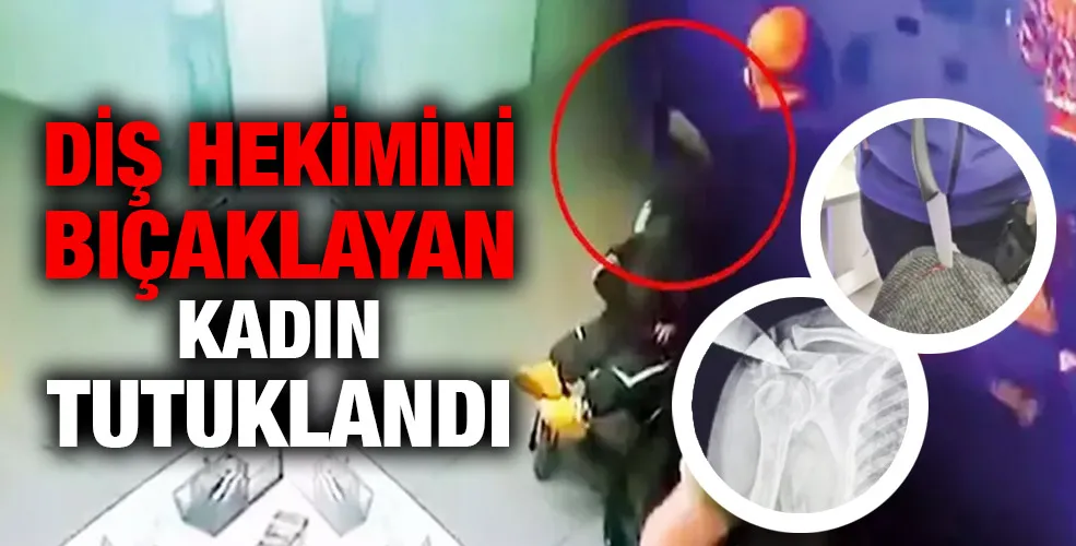 DİŞ HEKİMİNİ BIÇAKLAYAN KADIN TUTUKLANDI!