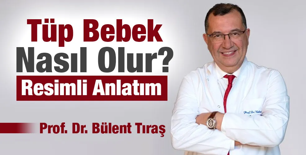 Tüp Bebek Nasıl Olur?