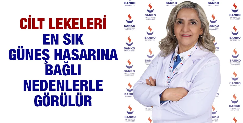 CİLT LEKELERİ EN SIK GÜNEŞ HASARINA BAĞLI NEDENLERLE GÖRÜLÜR