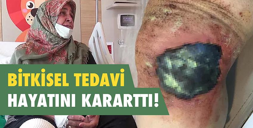 Bitkisel tedavi hayatını kararttı!