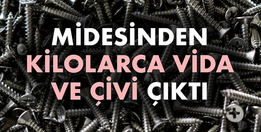 Midesinden kilolarca vida ve çivi çıktı