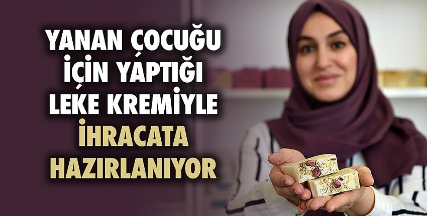 Yanan çocuğu için yaptığı leke kremiyle ihracata hazırlanıyor